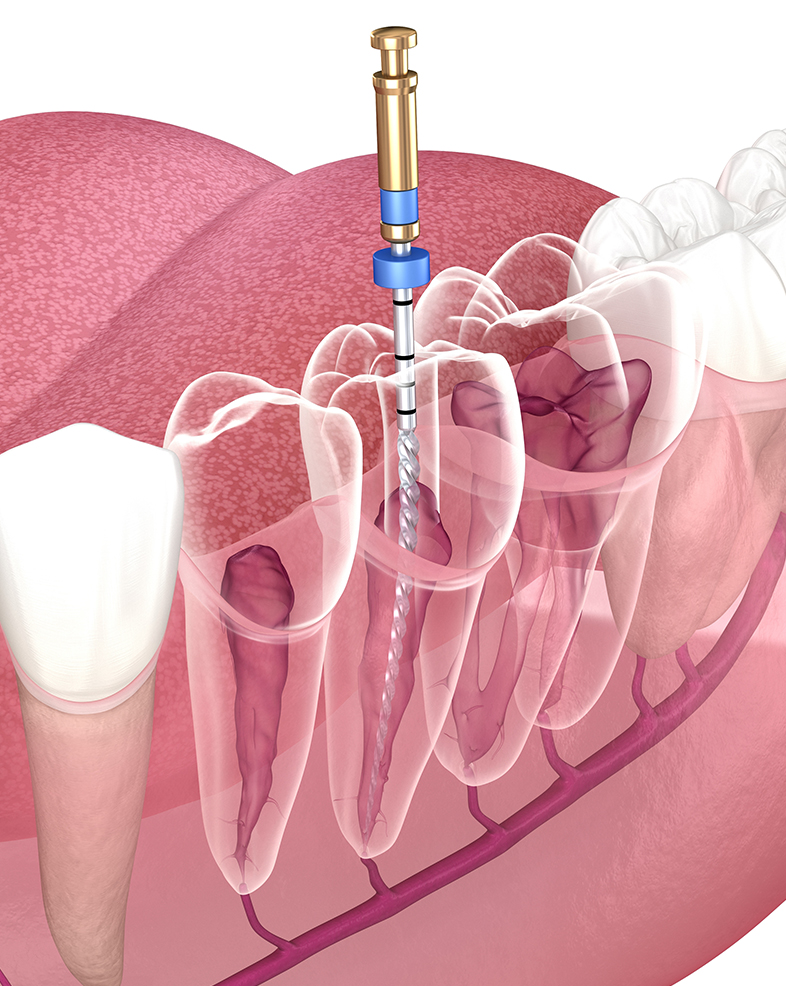 Treatments - Herongate Dental Surgery